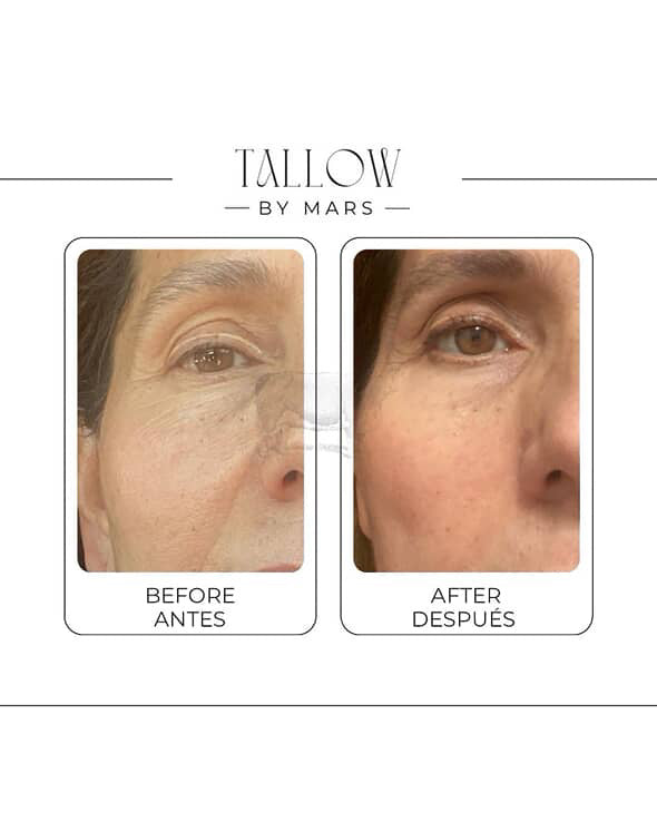 TALLOW by Mars       MÉXICO